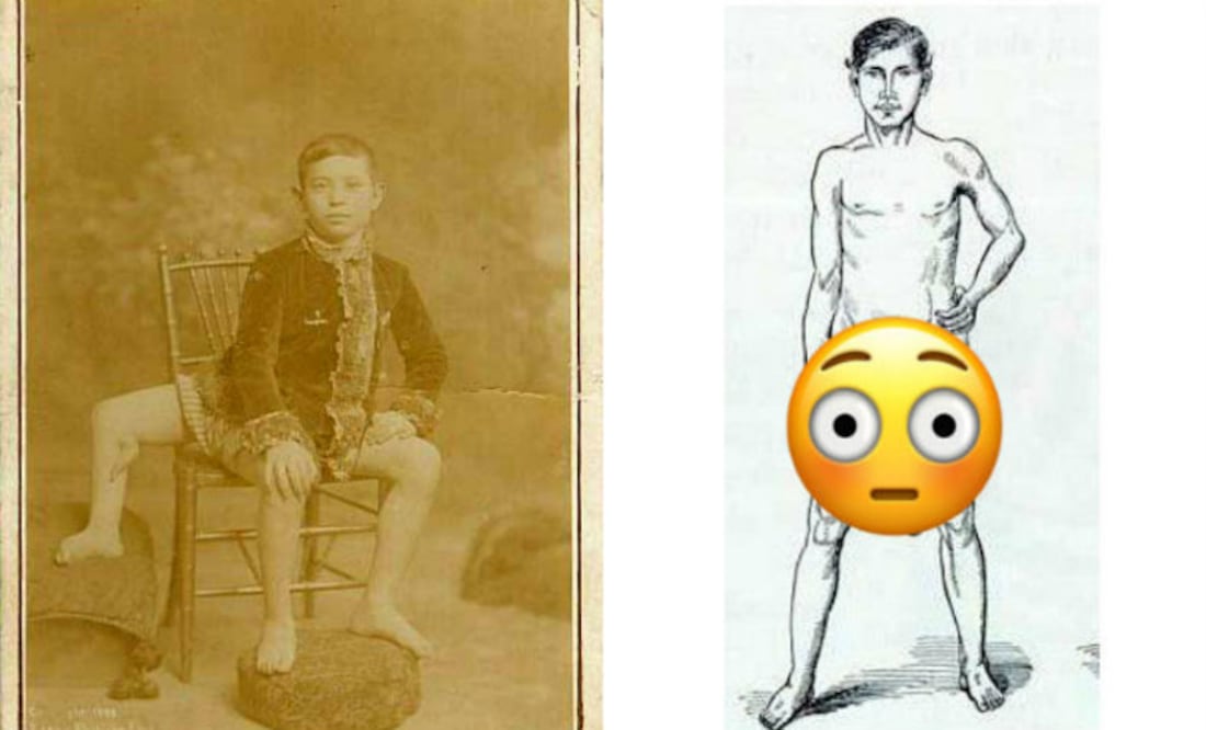 Foto: Wikipedia/Internet/Emojipedia