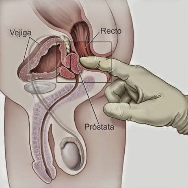 Próstata, la zona erógena masculina olvidada