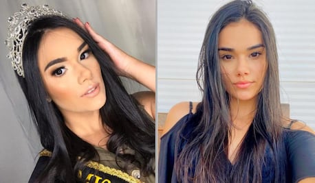 Video: Muere reina de belleza de 21 años durante cirugía en Brasil