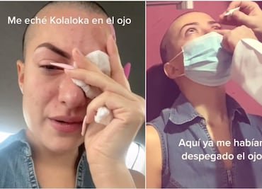 Tiktoker confunde gotas para ojos… ¡con pegamento!
