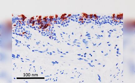 Ómicron infecta "más rápido y mejor" que Delta, pero con menor gravedad en pulmón