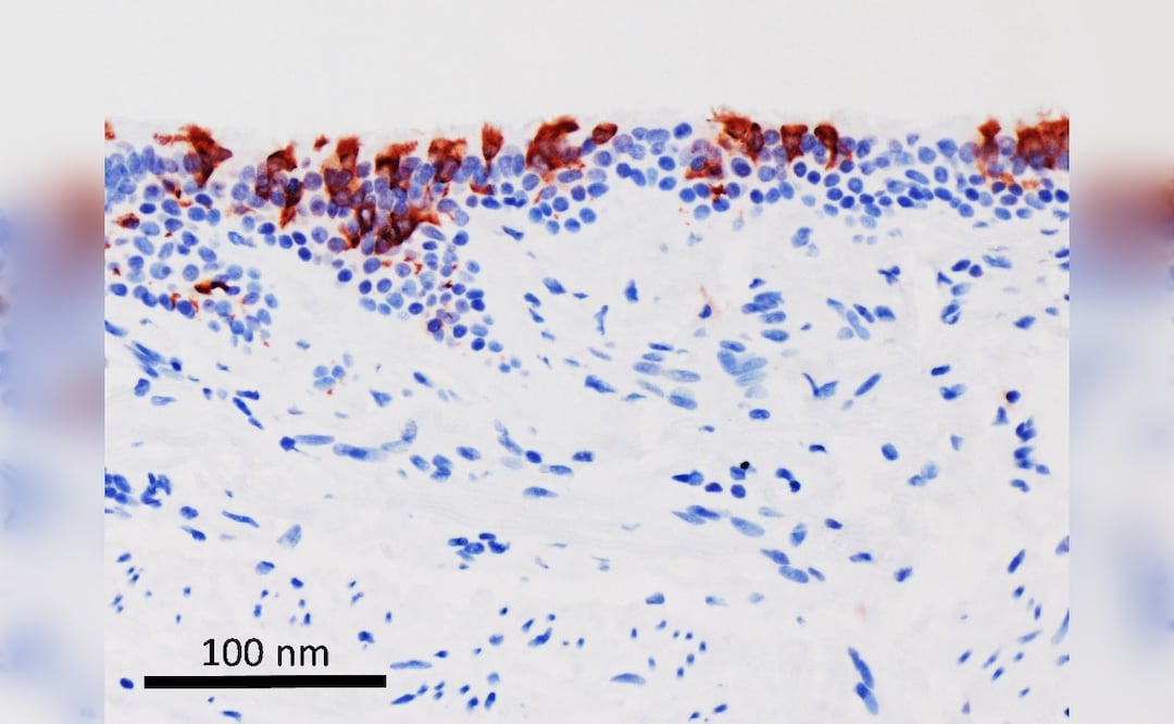 La variante omicrón del SARS-CoV-2 (en rojo) infectando tejidos de bronquios humanos. (Foto: Universidad de Hong Kong vía EuropaPress)