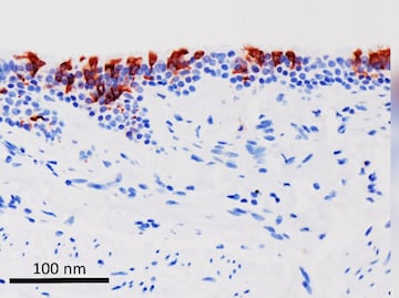 Ómicron infecta "más rápido y mejor" que Delta, pero con menor gravedad en pulmón