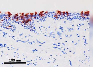 Ómicron infecta "más rápido y mejor" que Delta, pero con menor gravedad en pulmón