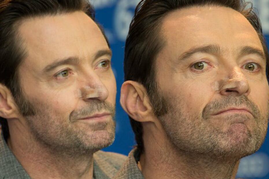 Hugh Jackman ha padecido cuatro tipos de cáncer en la piel... ¡Él sigue luchando!