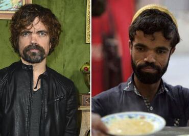¡Separados al nacer! El “doble” de Peter Dinklage vive en Pakistán