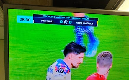 ¡No bueno! Fox Sports cometió tremendo error en la transmisión del Pachuca vs América