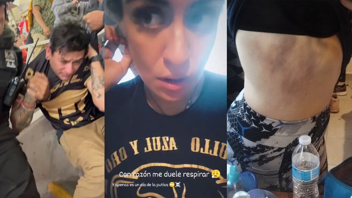 Aficionados de Pumas siendo golpeados y marcas de violencia / FOTOS: El Universal