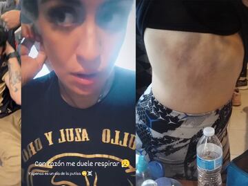 Aficionada de Pumas denuncia brutalidad y robos de los policías en el Estadio Akron