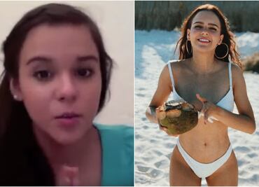 El antes y después de Yuya, la reina de Youtube