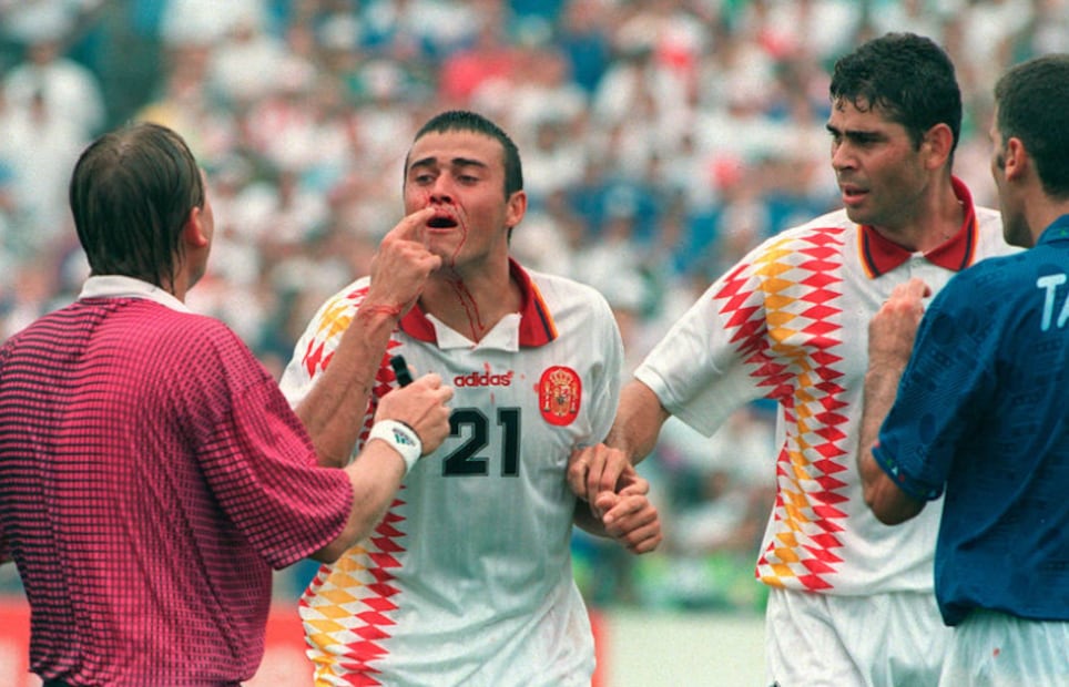 La sangre en el rostro de Luis Enrique / Foto: Especiales