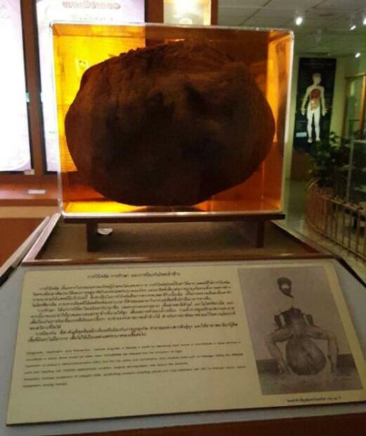 ¡Precaución! Fotos del museo más siniestro del mundo