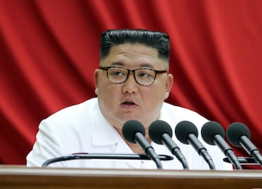 Kim Jong-un… ¿El líder norcoreano al borde de la muerte?