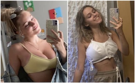 Joven reduce el tamaño de sus senos para evitar acoso en las calles