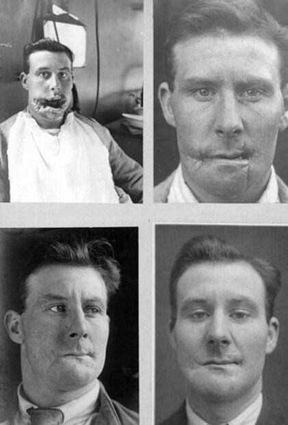 10 cirugías que revolucionaron el mundo de la medicina