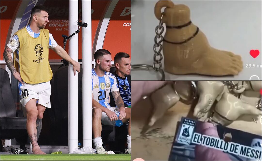 Así lucen los llaveros del tobillo lastimado de Lionel Messi. FOTO: AFP
