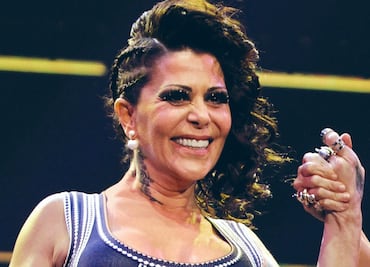 Alejandra Guzmán revela que ha tenido 40 cirugías y que pensó en morir