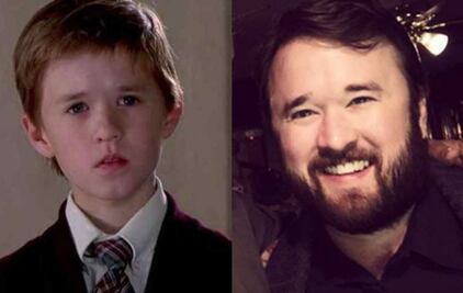 El antes y después de Haley Joel Osment, el niño de “Sexto sentido”