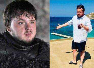 La dura lucha de "Sam” de Game of Thrones para aceptar su peso