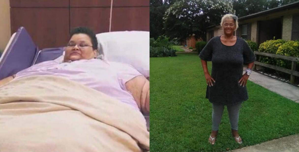 10 casos extremos de personas con obesidad que lograron bajar de peso