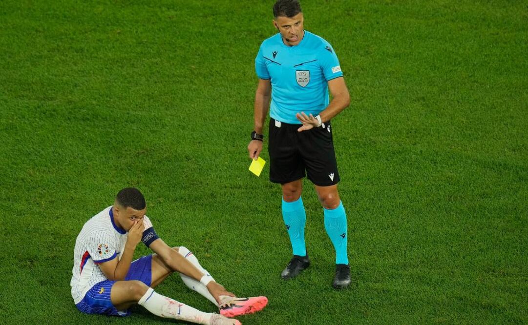 El jugador francés tendrá que ser operado. Agencias.