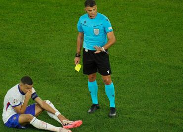 Kylian Mbappé estrella de Francia en la Eurocopa sufre fractura y tendrá que ser operado