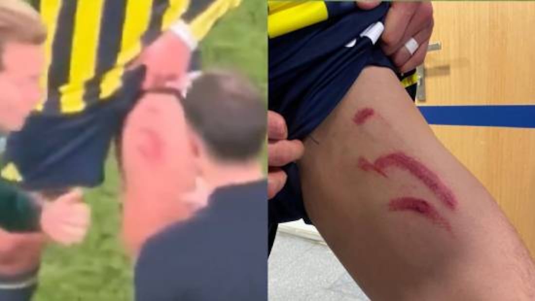 Así quedó la pierna de Edson Álvarez luego de la agresión que sufrió. Foto: Especial