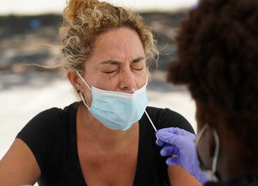 Estudio revela que Covid largo puede tener más de 200 síntomas