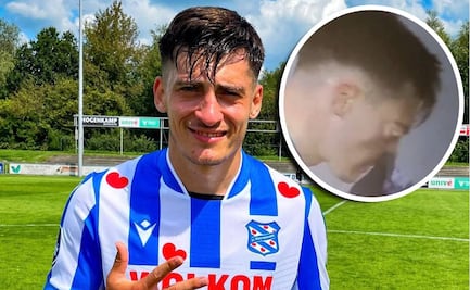 A jugador se le salió un ojo en pleno partido luego de que se sonara la nariz