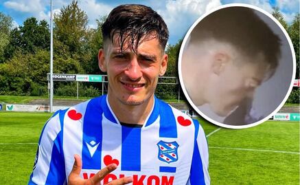 A jugador se le salió un ojo en pleno partido luego de que se sonara la nariz