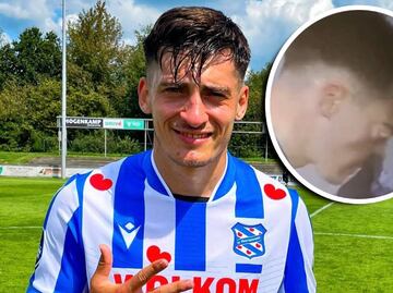 A jugador se le salió un ojo en pleno partido luego de que se sonara la nariz