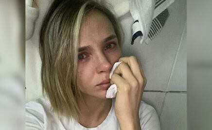 Modelo muestra sus glúteos destrozados por una mala cirugía