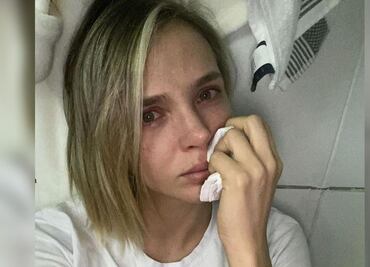 Modelo muestra sus glúteos destrozados por una mala cirugía