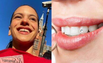 Gemas dentales: ¿Es seguro sumarse a esta tendencia?