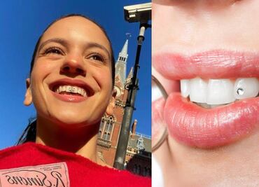 Gemas dentales: ¿Es seguro sumarse a esta tendencia?