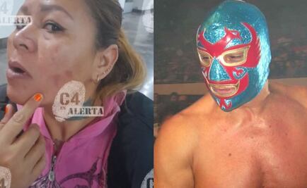 Exluchador 'Dos Caras' es acusado de ejercer violencia contra su esposa: la quemó con ácido y le pegaba