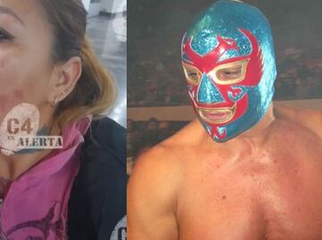 Exluchador 'Dos Caras' es acusado de ejercer violencia contra su esposa: la quemó con ácido y le pegaba