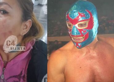 Exluchador 'Dos Caras' es acusado de ejercer violencia contra su esposa: la quemó con ácido y le pegaba