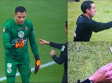 Luis Ángel Malagón fue agredido con un cortaúñas tras el silbatazo inicial del Toluca vs América