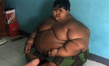 Así luce ahora “el niño más gordo del mundo”