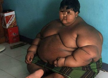 Así luce ahora “el niño más gordo del mundo”