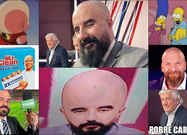 Álvaro Morales es víctima de los MEMES, tras de pagar su apuesta y raparse en pleno programa