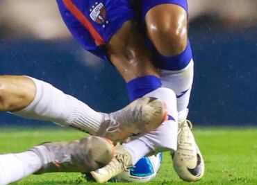 Hobbit Bermúdez sufrió una entrada de cárcel que le provocó escalofriante lesión