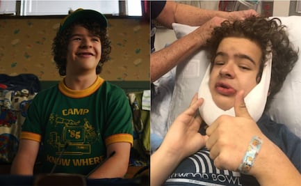 Gaten Matarazzo, el actor de “Stranger Things” y sus dolorosas cirugías