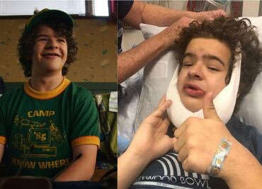 Gaten Matarazzo, el actor de “Stranger Things” y sus dolorosas cirugías