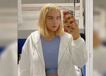 Joven se quema sus senos talla JJ en un asador y le niegan reducción