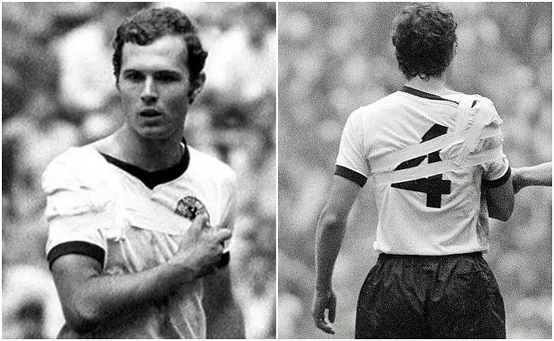 Franz Beckenbauer con el hombro dislocado en México 1986 / FOTOS: Especial
