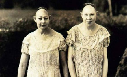 10 fotos de “fenómenos” de circo que te darán escalofrío