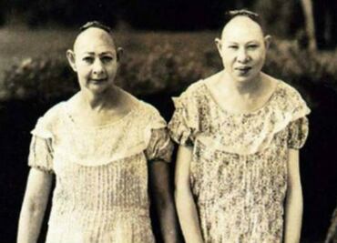 10 fotos de “fenómenos” de circo que te darán escalofrío