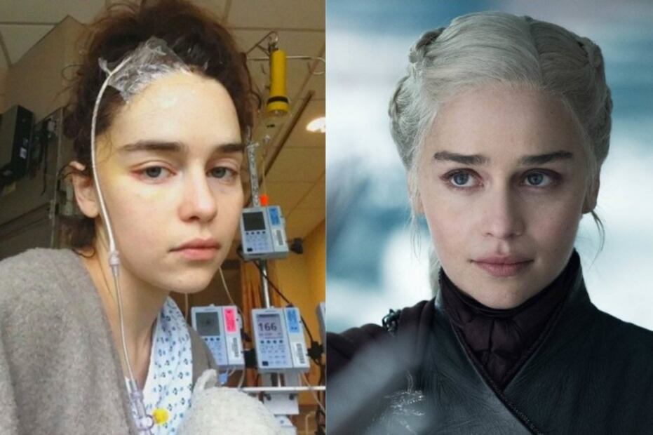 “Game of Thrones”: Los problemas de salud que sufrieron los protagonistas